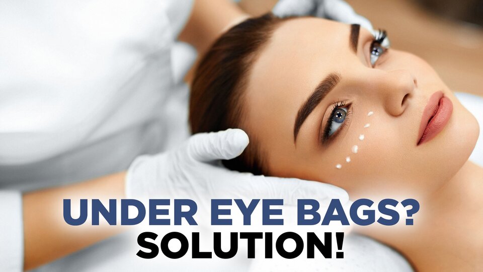 Under Eye Bags? SOLUTION!