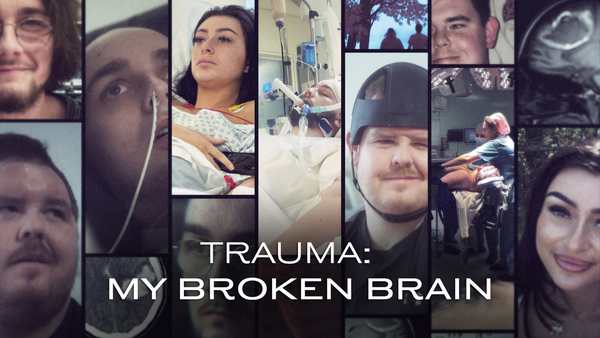 Trauma: My Broken Brain