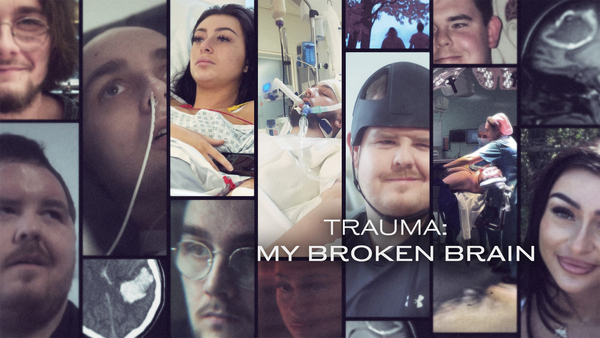 Trauma: My Broken Brain