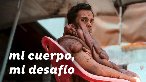 Mi cuerpo, mi desafío