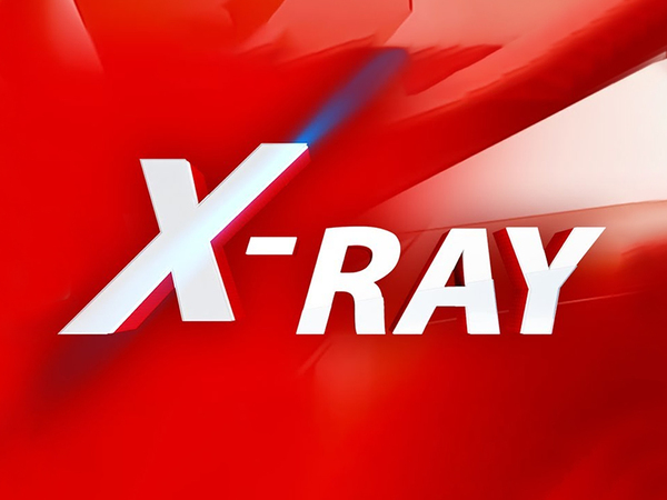 X Ray
